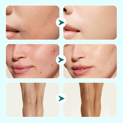 💜LAST DAY -49% OFF💜All-in-One Moisturizing Concealer Waterproof Cream For Women