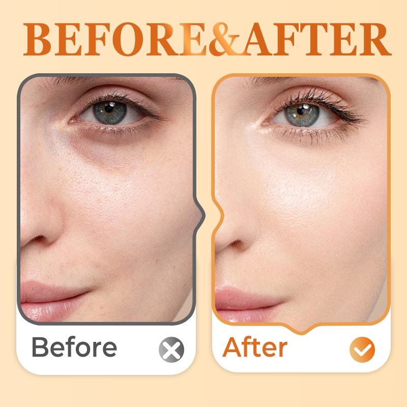 Whitening & Freckle Removing Essence - 2ml × 10pcs