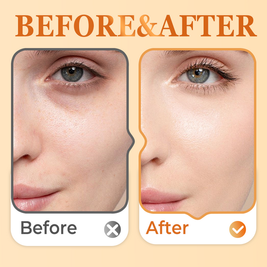 Whitening & Freckle Removing Essence - 2ml × 10pcs